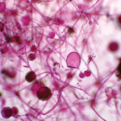 Rhizopus (Zygomycetes) Microscope Slides
