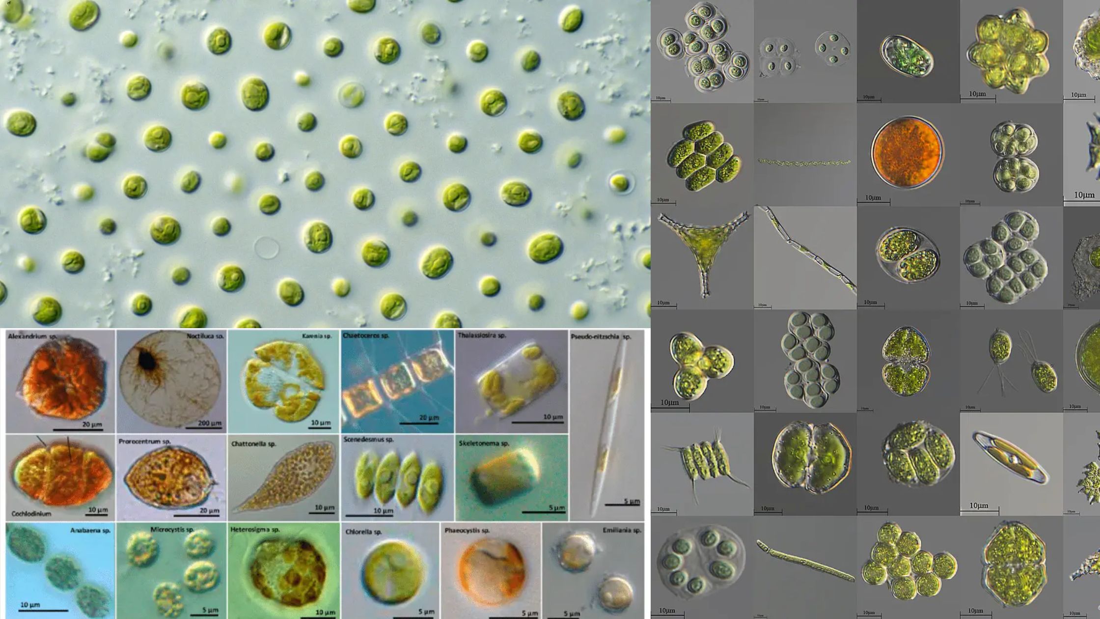 Algae Under Microscope