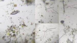 Diatoms Under the Microscope