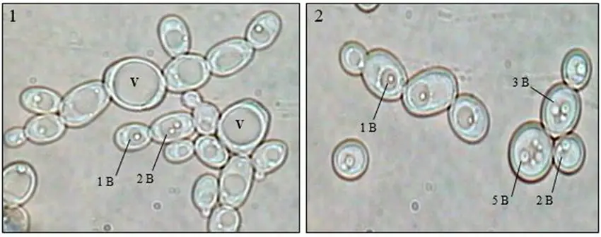 Light microscopy of yeast cells. 