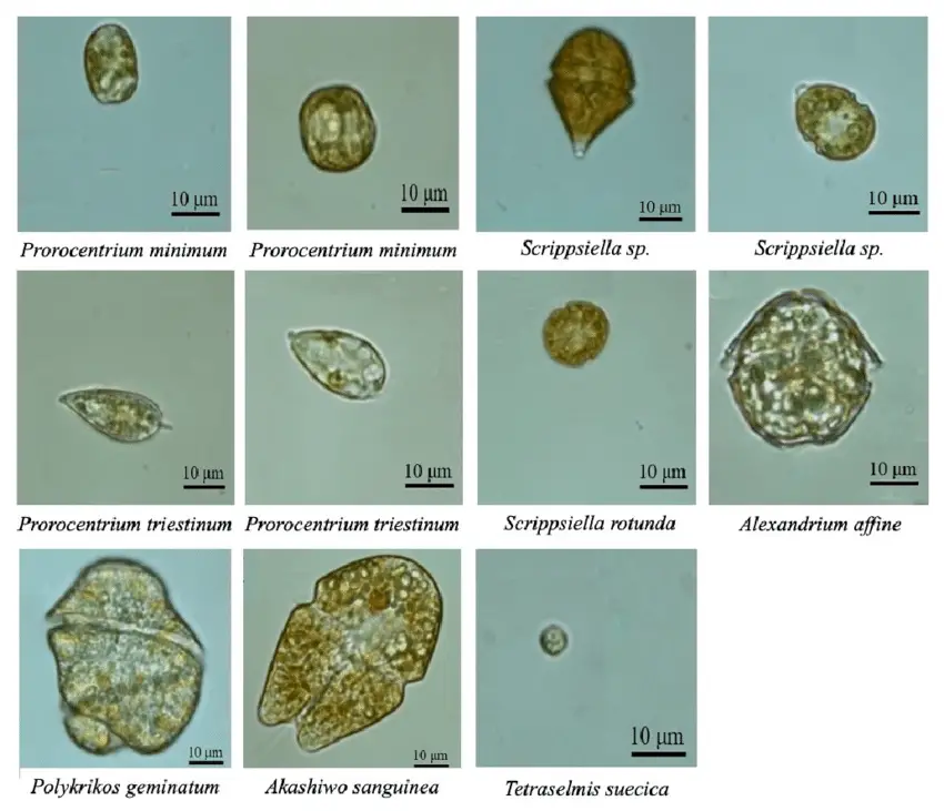 Morphology of algal strains used in this study under a light microscope (1000x).
