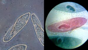 Paramecium Under Microscope