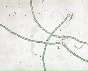 Anabaena Under Microscope