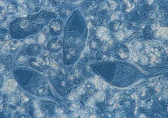 Three Hypermastigotes (Trichonympha sp.) and a Trichomonas sp. (top left) in the midst of a living soup of other small protists and partly decayed wood.

