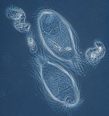 Trichonympha sp. with many long flagella

