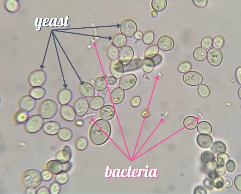 Yeast and Bacteria