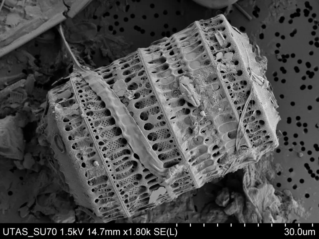 Diatoms Under Microscope