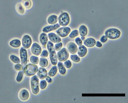 Yeast cells in young wine. Image courtesy microbiological garden.
