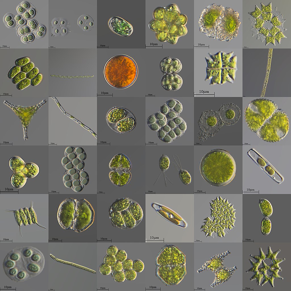 A variety of unicellular and colonial freshwater microalgae