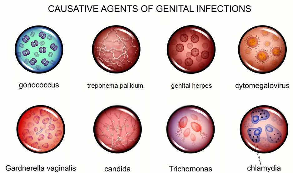 Most common STD causes
