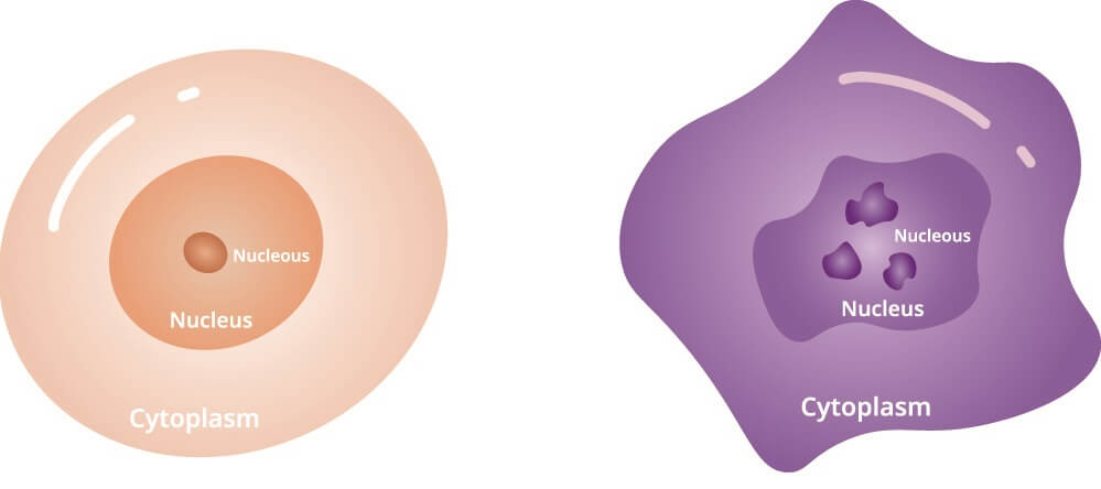 Normal cell (left) versus cancer cell (right).
