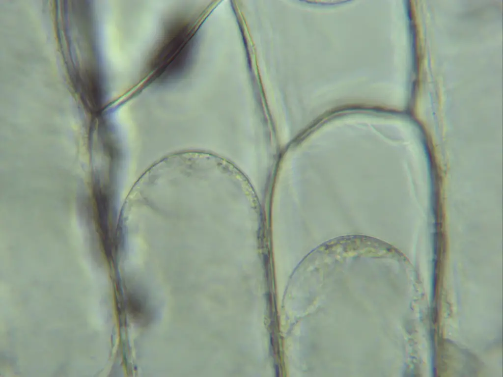 Plant cell undergoing Plasmolysis in a Hypertonic solution (x400 magnification)