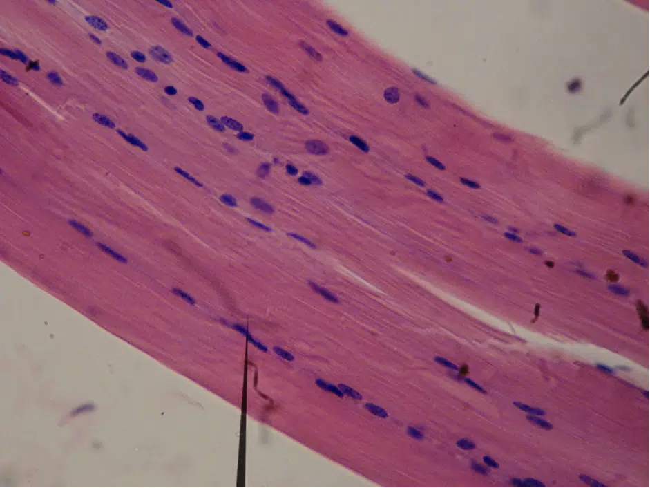 Smooth muscle fibres