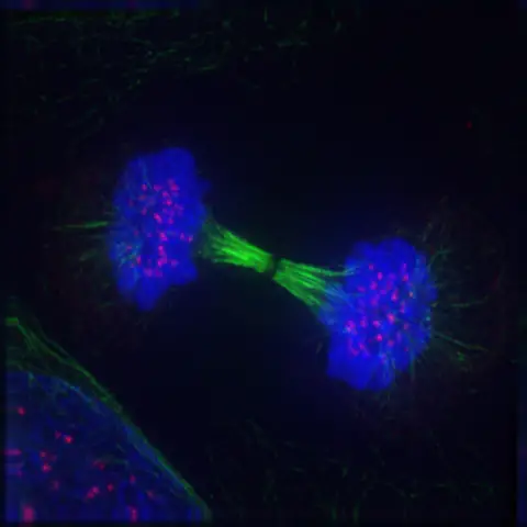 Fluorescence micrograph of a human cell in telophase showing chromosomes (DNA) in blue, microtubules in green and kinetochores in pink