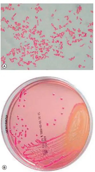 Yersinia pestis: Gram-staining appearance (A) and colonies grown on blood-agar (B).