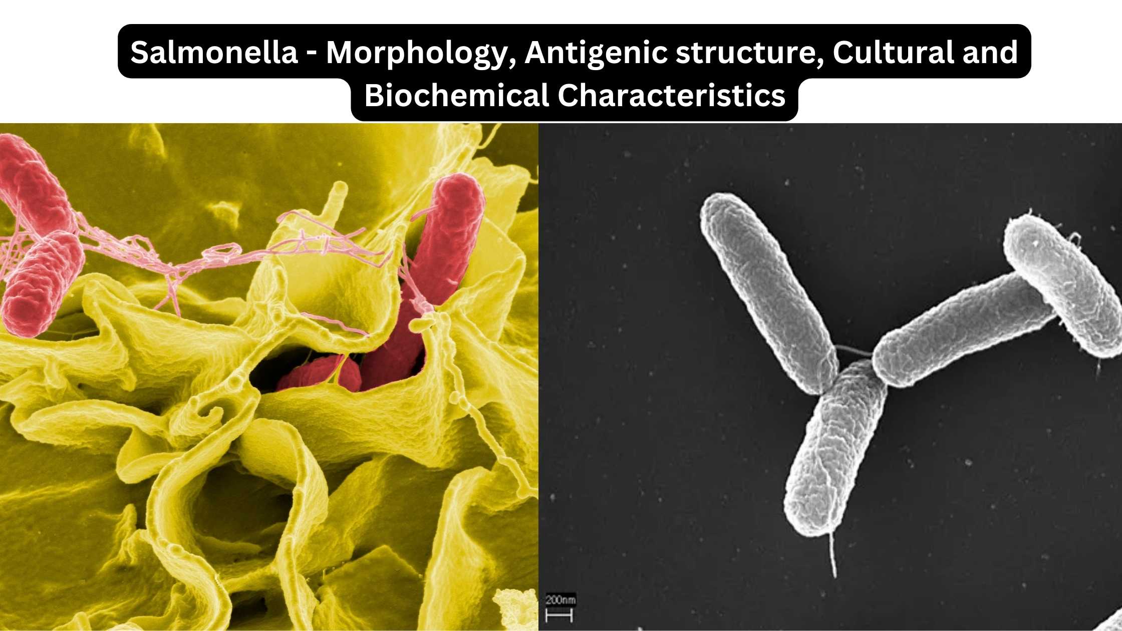 Salmonella - Morphology, Antigenic structure, Cultural and Biochemical Characteristics
