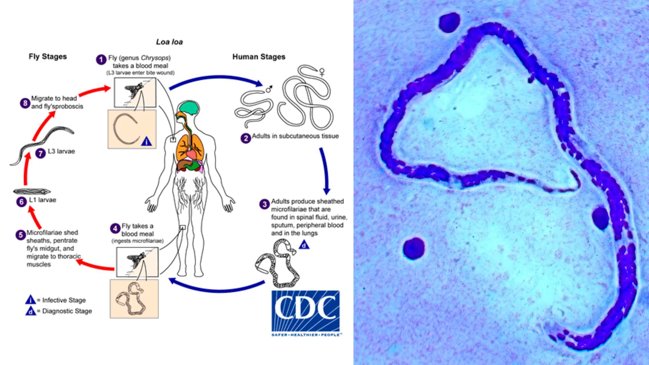 Loa loa Life cycle, Morphology, Pathogenesis, Diagnosis, Transmission, Treatment