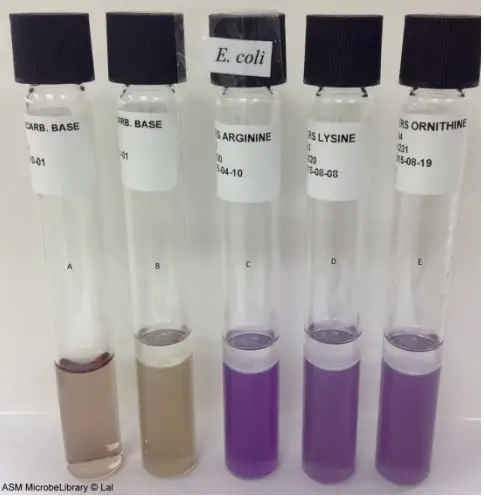 Moeller’s Decarboxylase media. A: Uninoculated base, B: Base inoculated with E. coli, C: Arginine broth inoculated with E. coli, D: Lysine broth inoculated with E. coli, E: Ornithine broth inoculated with E. coli. Purple color in tubes C, D, and E indicate that this strain of E. coli is arginine, lysine, and ornithine decarboxylase positive.