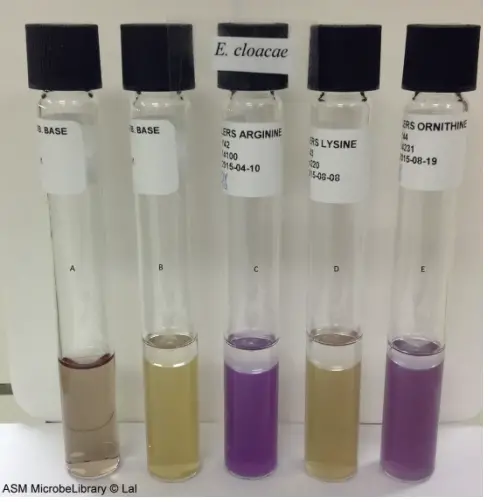 Moeller’s Decarboxylase media. A: Uninoculated base, B: Base inoculated withEnterobacter cloacae, C: Arginine broth inoculated with E. cloacae, D: Lysine broth inoculated with E. cloacae, E: Ornithine broth inoculated with E. cloacae. Purple color in tubes C and E indicate that E. cloacae is arginine and ornithine decarboxylase positive