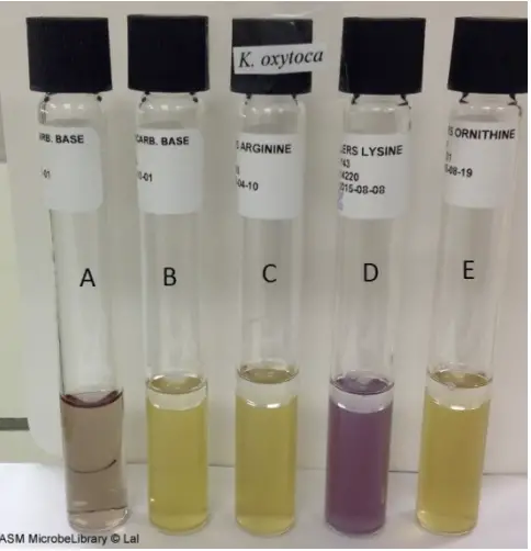 Moeller’s Decarboxylase media. A: Uninoculated base, B: Base inoculated withKlebsiella oxytoca, C: Arginine broth inoculated with K. oxytoca, D: Lysine broth inoculated with K. oxytoca, E: Ornithine broth inoculated with K. oxytoca. Purple color in tube D indicates that K. oxytoca is lysine decarboxylase positive while yellow color in tubes C and E (absence of purple color) indicates that it is arginine and ornithine decarboxylase negative.